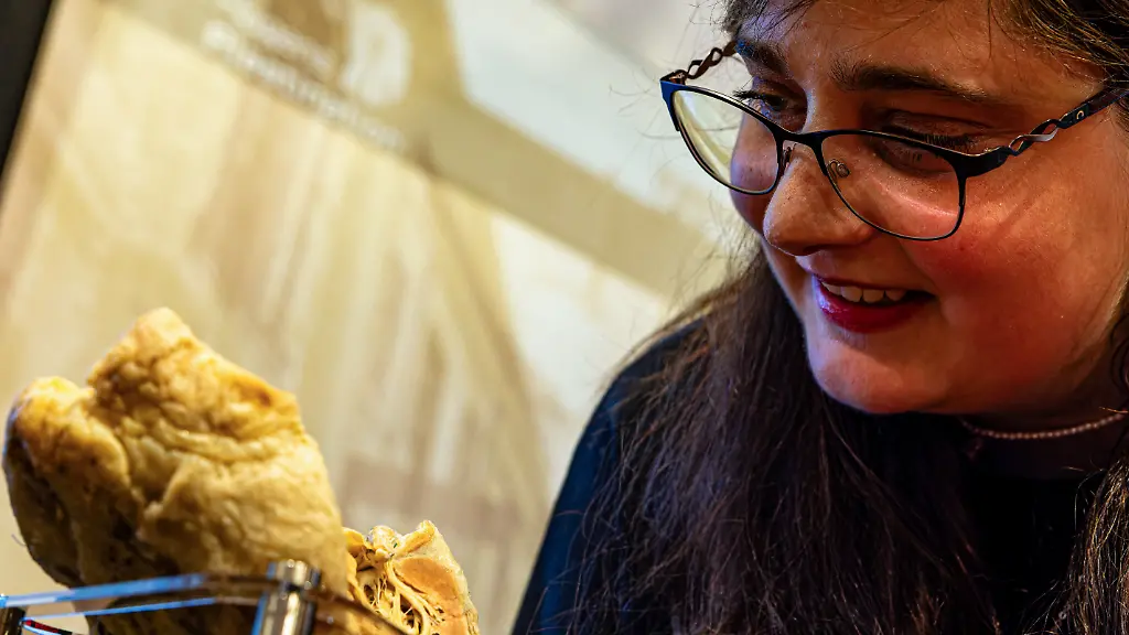 Martina Grabschs plastiniertes Herz erinnert an Transplantation