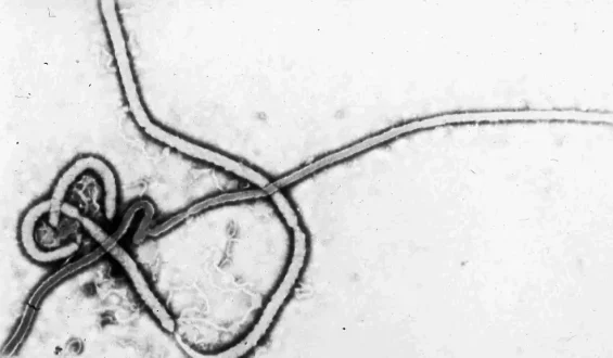Grundwissen über das Ebolavirus und seine Gefahren