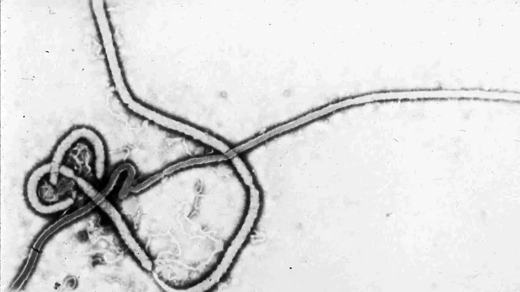Grundwissen über das Ebolavirus und seine Gefahren