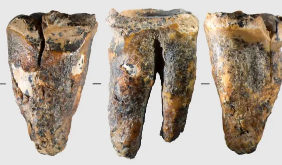 Neandertaler beherrschten Zahneingriffe vor 60.000 Jahren