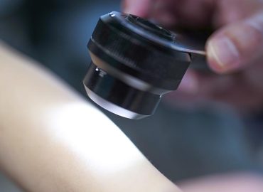Studie zu Rückfällen: Hoffnung durch mRNA-Impfung gegen Hautkrebs