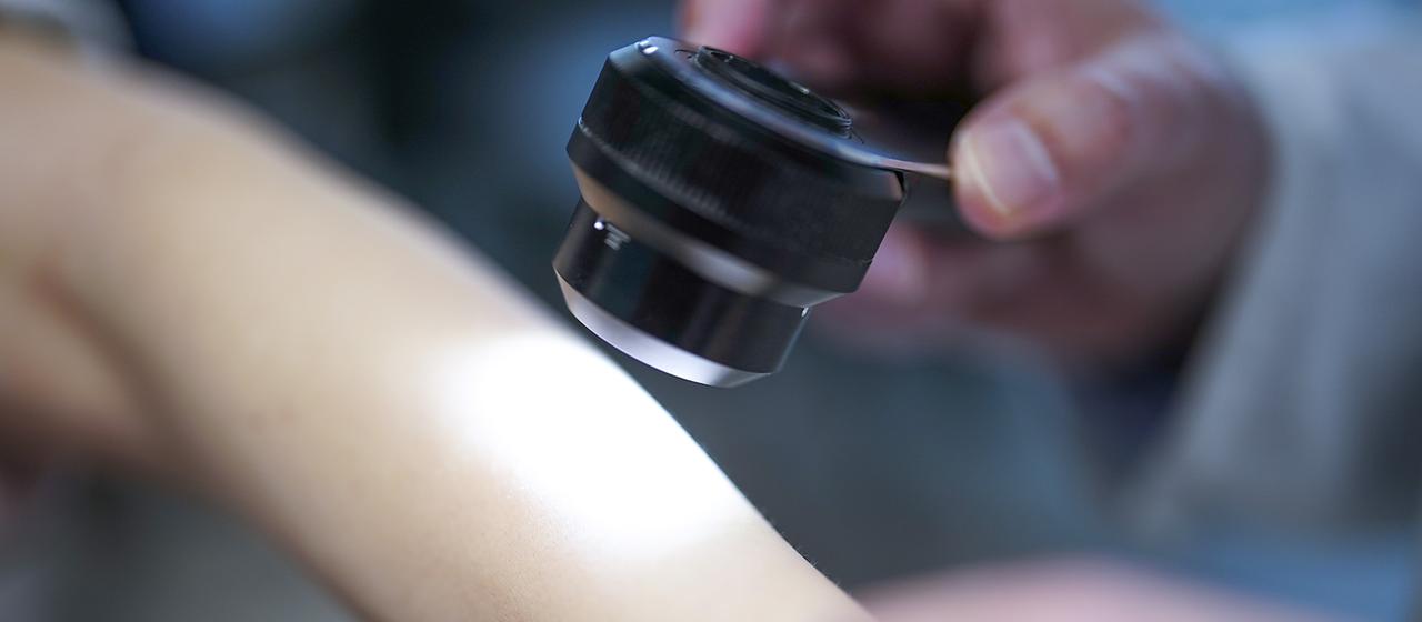 Studie zu Rückfällen: Hoffnung durch mRNA-Impfung gegen Hautkrebs