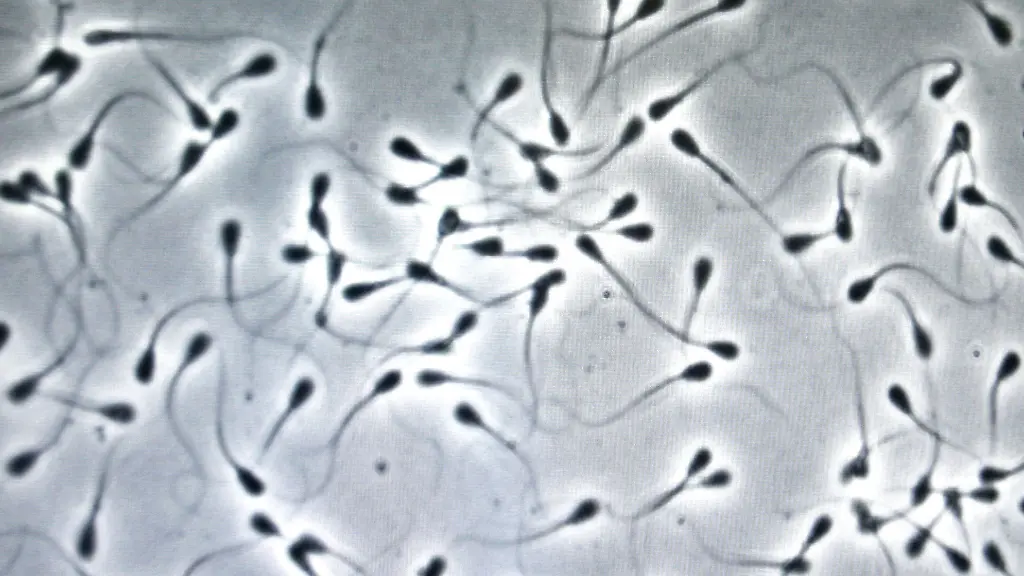 Luftverschmutzung und ihre Auswirkungen auf die Spermien-DNA