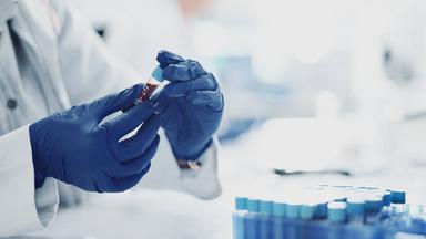 Herausforderungen und Nachsorge von Sepsis-Überlebenden